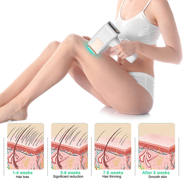 FY-B506 At-Home IPL Hair Removal